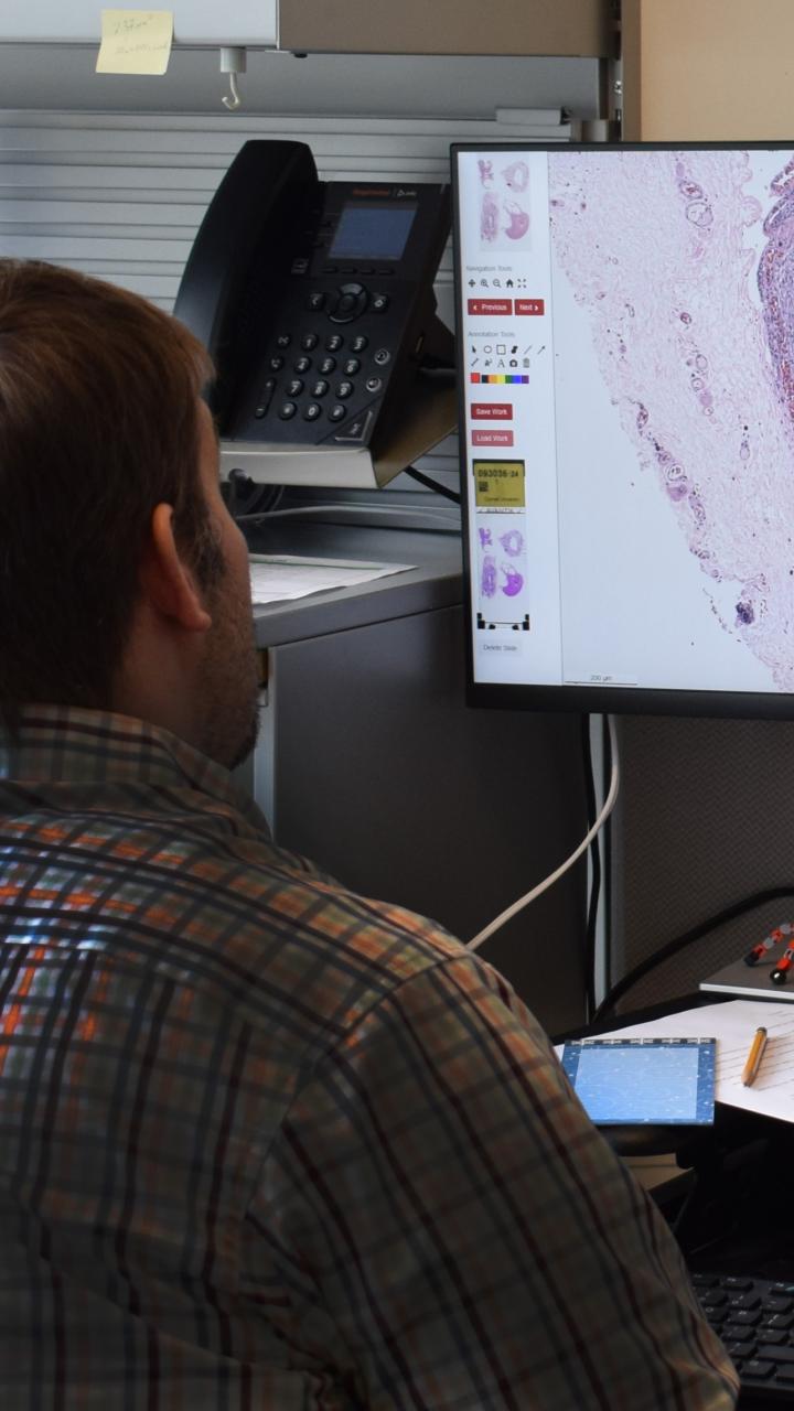 Dr. Hitchener reviewing a histopathology slide on computer monitor
