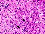 H&E: Arrows point to inclusion bodies within affected tissues
