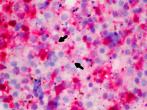 Immunohistochemistry: Arrows point to inclusion bodies within affected tissues