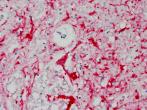 Histo slide of positive neuron test result