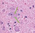 Rabies inclusions (Negri bodies)in the brain of a white-tailed deer