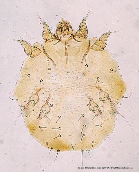 Sarcoptes-scabiei under microscope