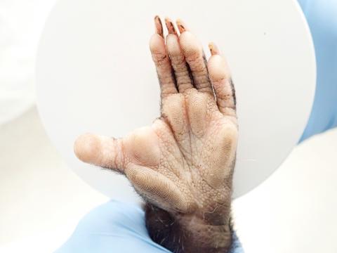 The opposable “thumbs” (halux) on their back feet