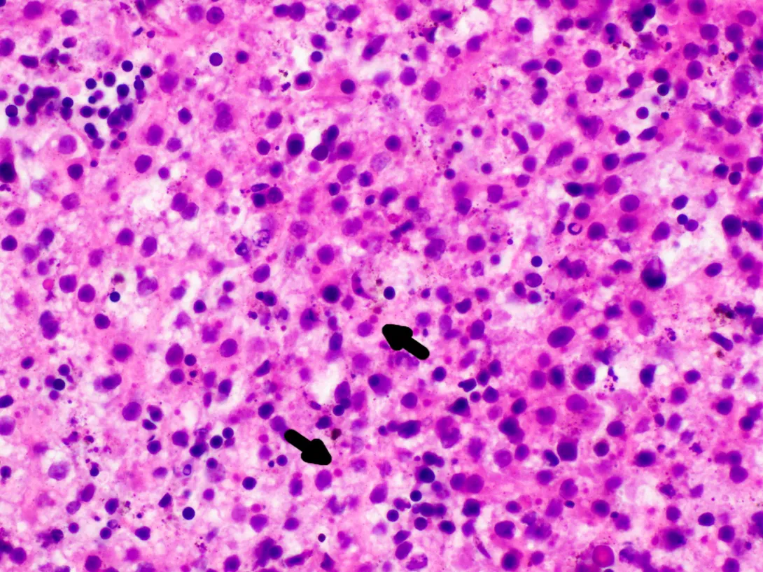 H&E: Arrows point to inclusion bodies within affected tissues