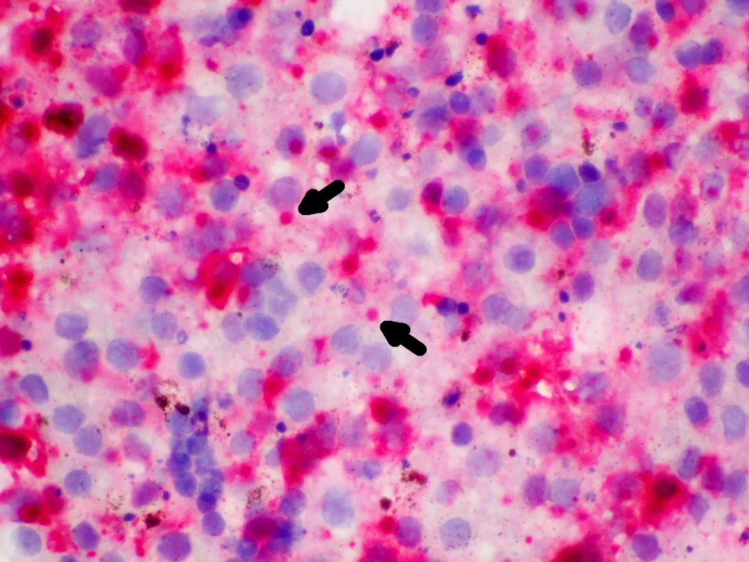 Immunohistochemistry: Arrows point to inclusion bodies within affected tissues